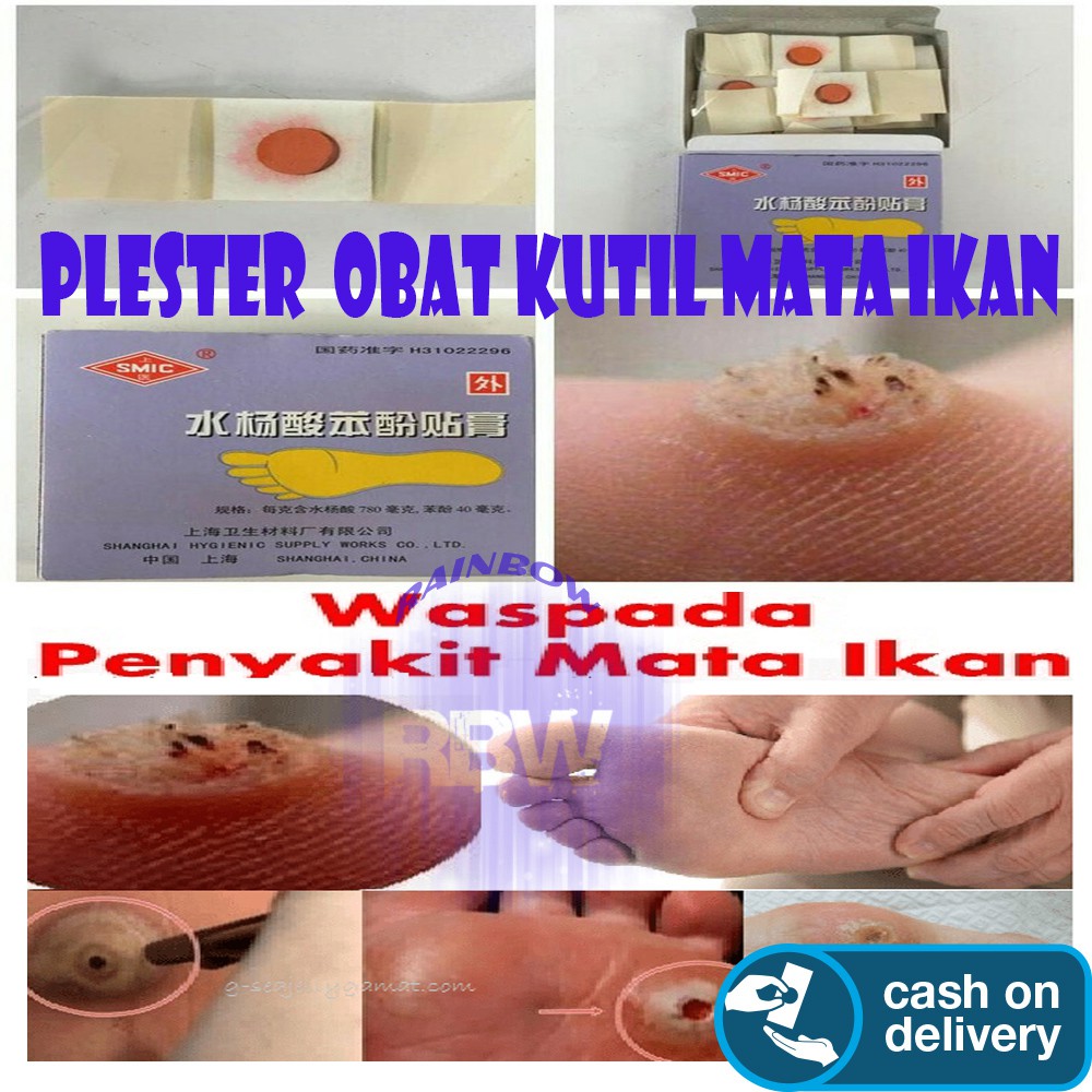 Koyo (1 BOX 6pcs) Plester Obat Kutil & Mata Ikan / Penutup Kutil / Koyo Kutil / Penutup Mata Ikan-1