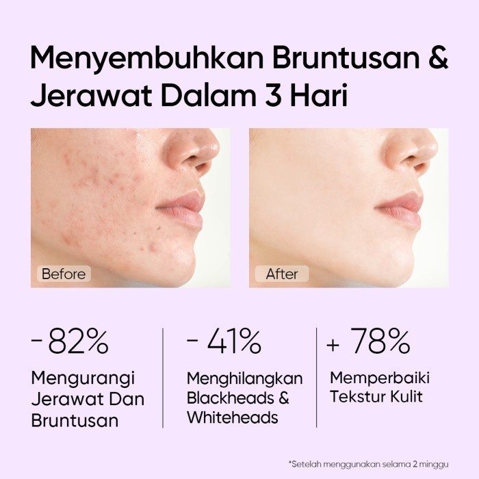 ✨ AKU MURAH ✨ Skintific 5% AHA BHA PHA Exfoliating Toner 80ml BPOM