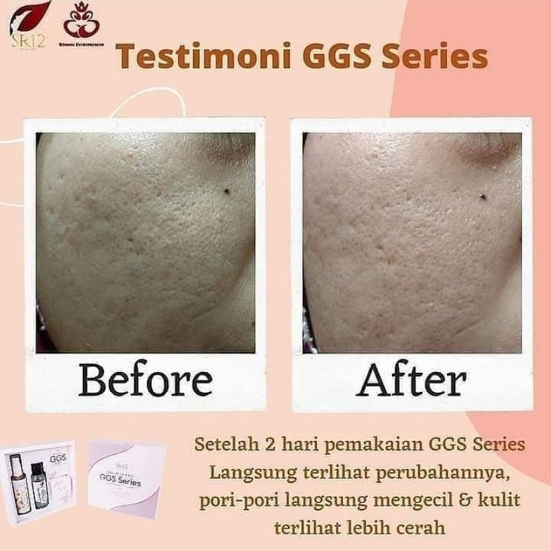 Glow Glass Skin Gel Premium Glasskin Brightening Krim Pemutih Penghilang Bintik Wajah Penghilang Flek Hitam diWajah Brightening Moisture Gel Cream Cream Gel Cream Glowing