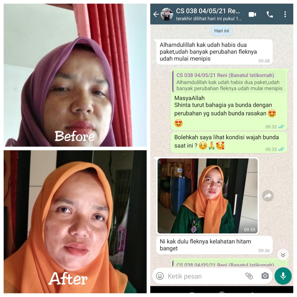 Night krim vas skincare cream glowing mencerahkan wajah dan meredakan jerawat ampuh bpom alami asli original