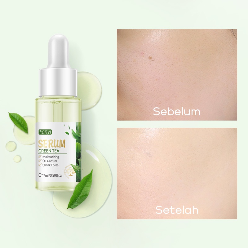 BPOM Fenyi Green Tea Serum Wajah Menghaluskan Menghilangkan Bekas Jerawat Mengecilkan Pori-pori 17ml