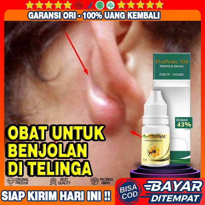 Obat Benjolan DI Belakang Telinga, Obat Pengempis Benjolan Nyeri, Obat Oles Benjolan, Propolis SM