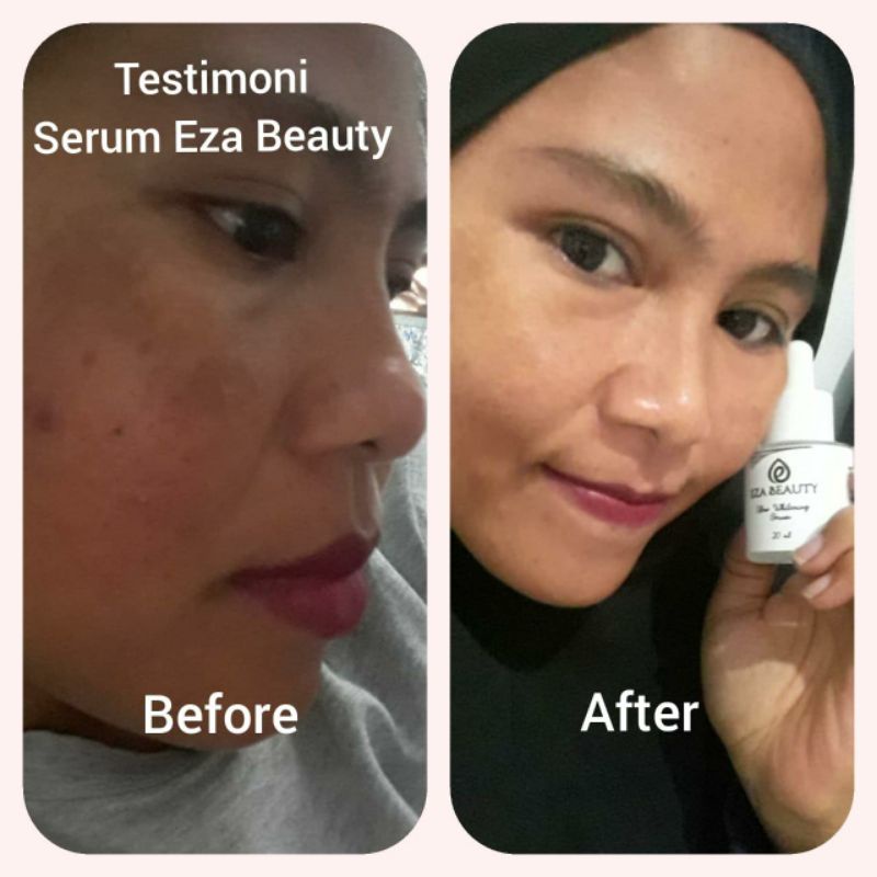 serum eza beauty