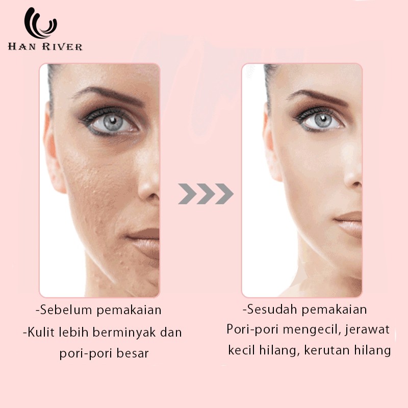 alat setrika wajah glowing ion 4in1 /setrika wajah penghilang kerutan/alat pijat wajah/alat pengencang wajah