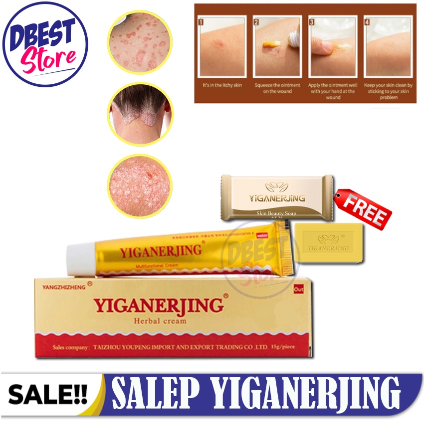 [BAYAR DITEMPAT] Yiganerjing Obat Eksim Gatal Jamur Alergi Herbal Antifungal Cream Psoriasis Vitiligo Skin / Obat Gatal Salep Penghilang Bekas Luka Obat Belang Putih di Kulit