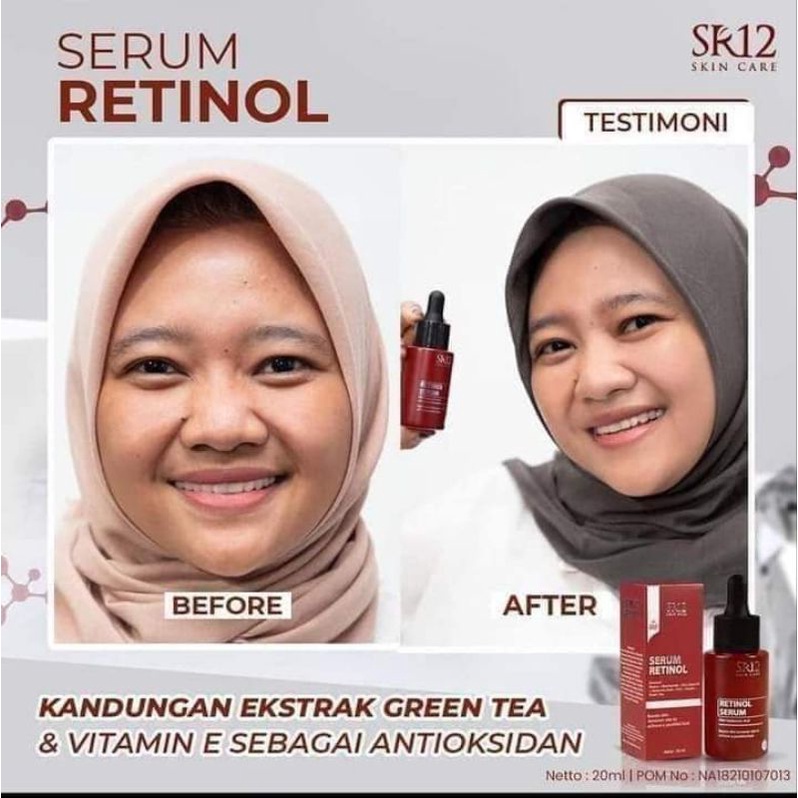 Retinol Serum SR12 Serum Wajah Retinol Mengatasi Jerawat Komedo Flek Hitam Melembabkan Mencerahkan Kulit Muka Original 100%