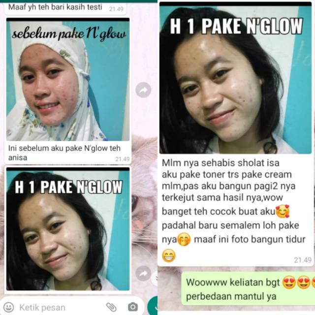 cream n glow skincare