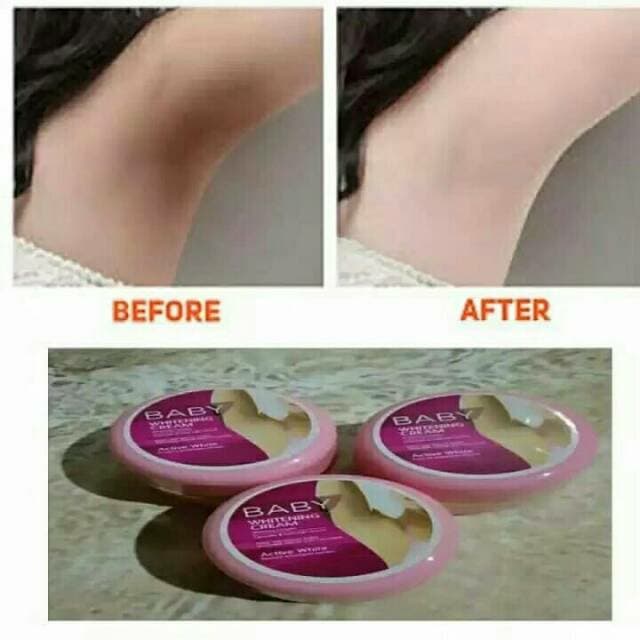 [100% Ampuh] Pemutih Ketiak BABY WHITENING Cream Pemutih Shinkurim Ori - Ketiak Putih Bersih dalam Seminggu Ampuh - Pemutih Leher dan Area Kewanitaan