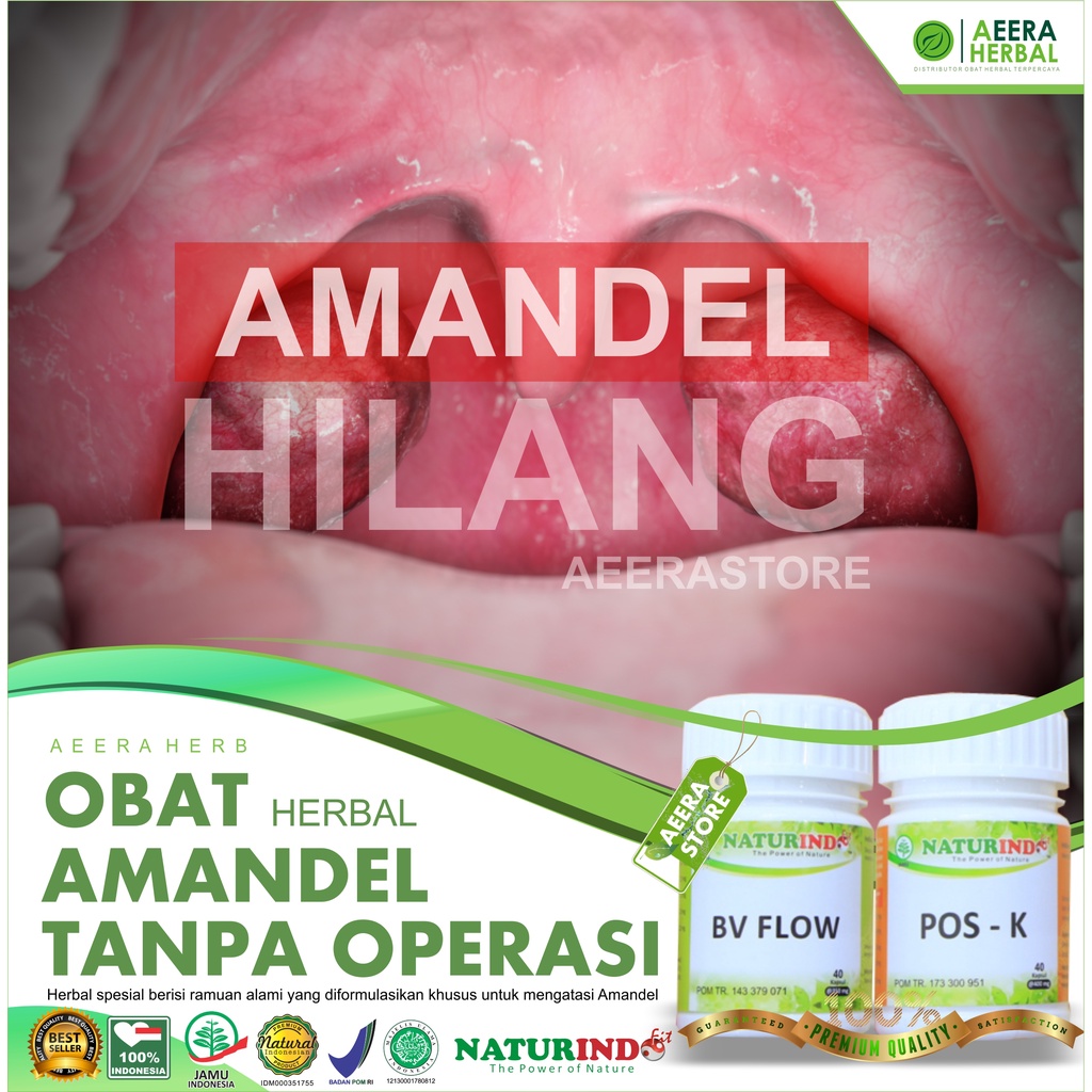 Obat Amandel - Radang Amandel - Sakit Tenggorokan - Sulit Menelan - Herbal Tanpa Operasi