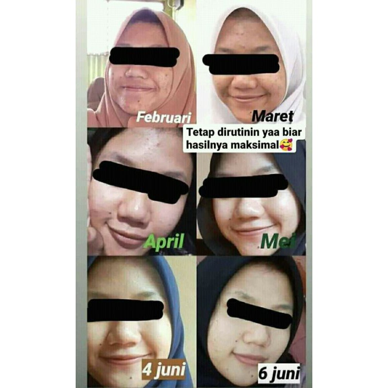 

Maskyourneeds25