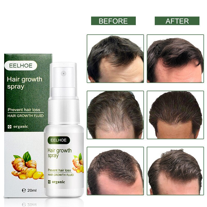 penumbuh rambut penumbuh rambutbotak serum penumbuh rambut 30g serum rambut rontok Penumbuh RambutCepat Anti Rontok Mengatasi Botak