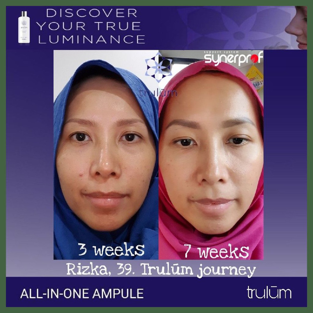 Trulum Spray Merk Cream Pemutih Wajah Aman | Pemutih Wajah Cepat Aman