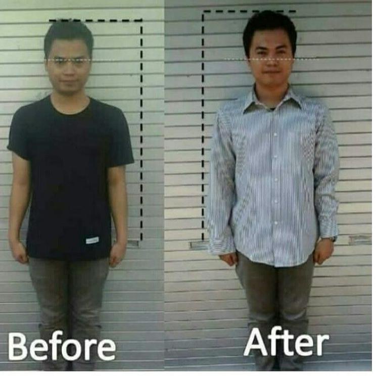 

Terbaik Hari Ini!! [] PAKET PENINGGI BADAN TERBAIK | PENINGGI TUBUH ALAMI | ZINC + SUSU CALSIUM 100% ORIGINAL TIENS hpxq235