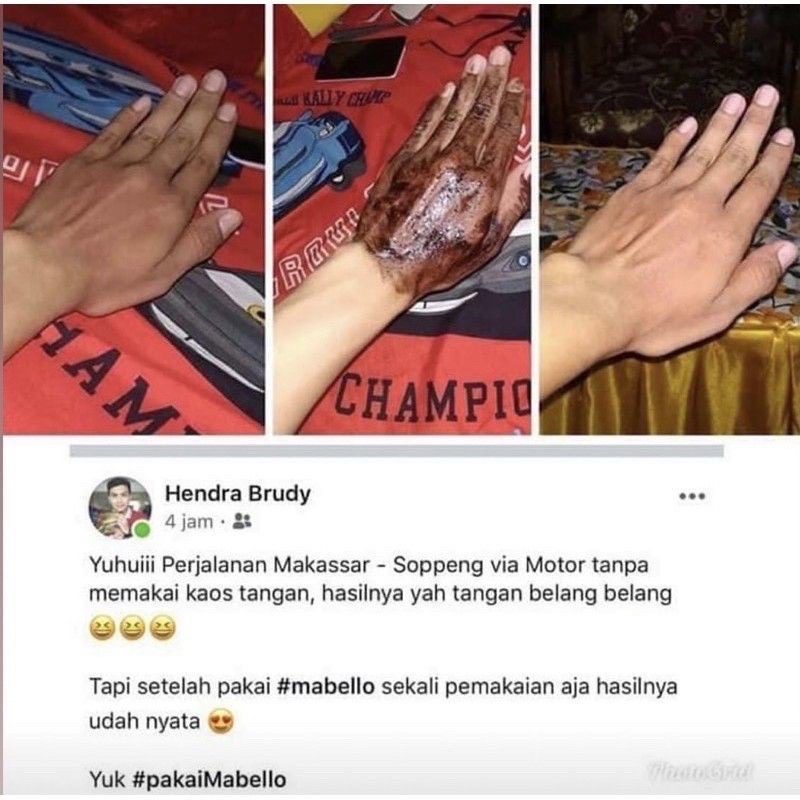 MABELLO BEDDA LOTONG LULUR HITAM BPOM &amp; HALAL MUI 1000% ORIGINAL