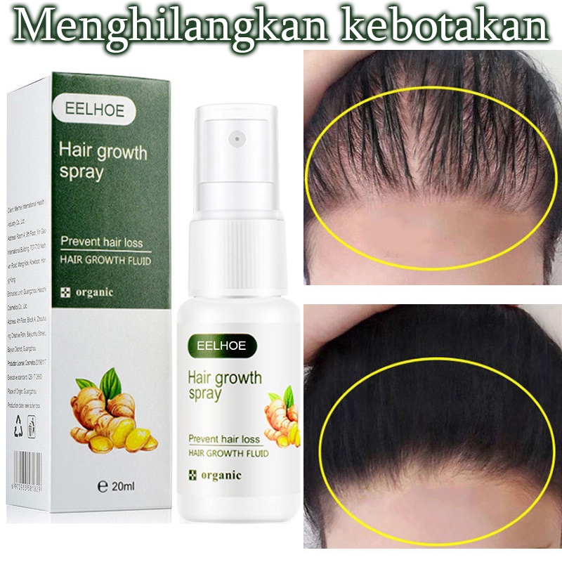 Hair growth serum spray Anti tonik rambut rontok Pertumbuhan rambut cepat 20G Serum Pemanjang &amp; Penumbuh Rambut tercepat No1 Di Indonesia