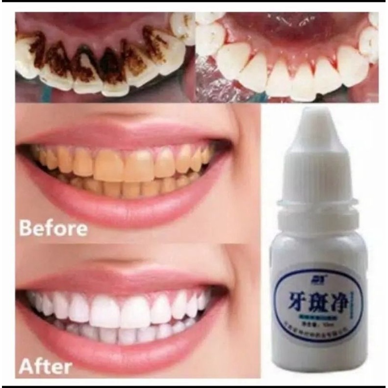 YABANJING WHITENING TEETH / YABANJING PEMUTIH GIGI 10ML