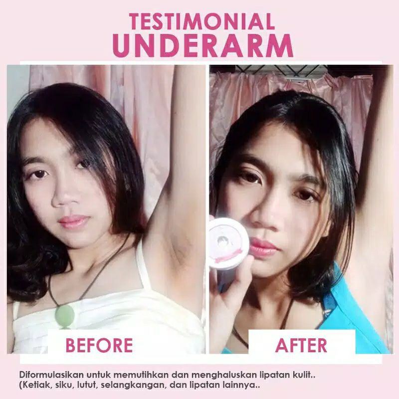 MS Glow Under Arm Cream Pemutih Ketiak Krim Pemutih Ketiak Cream Pencerah Ketiak Krim Original Asli