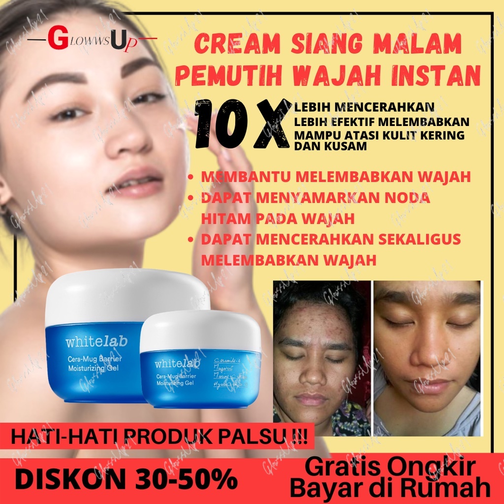 Pelembab Wajah Berminyak dan Berjerawat Whitelab Cera-Mug Barrier Moisturizing Gel