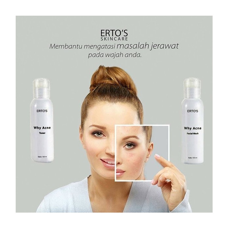 ERTOS WHY ACNE TONER ERTO'S WHY ACNE TONER PERAWATAN WAJAH ANTI JERAWAT BPOM ORIGINAL 100%