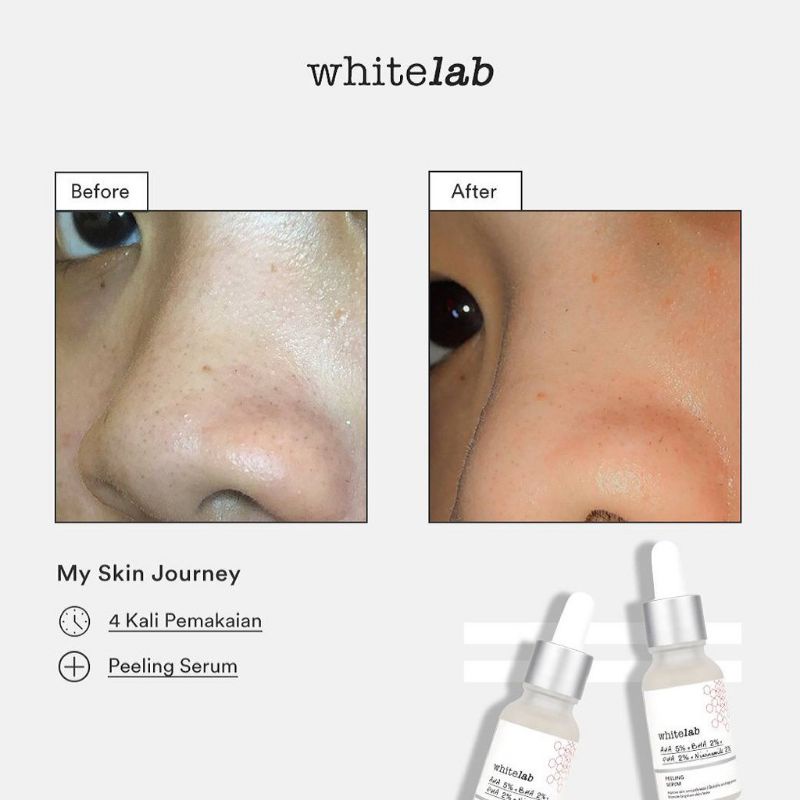 WHITELAB PEELING SERUM AHA 5%+BHA 2%+PHA 2% + Niacinamide 2%