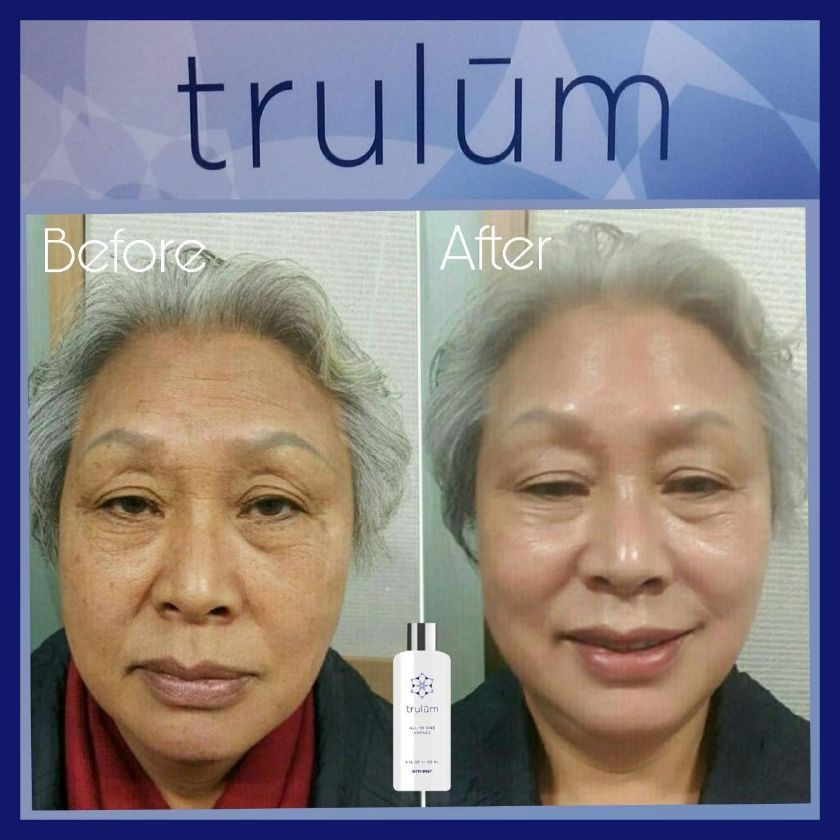 Mengencangkan Wajah Penghilang Kerutan Ganti Paket Cream Wajah Trulum