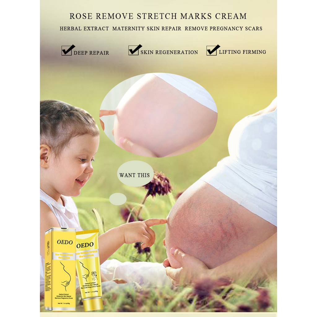 [Bisa COD] OEDO Rose Menghilangkan Stretch Mark Cream Nourish Pelembab Anti-Kerut Wanita Hamil