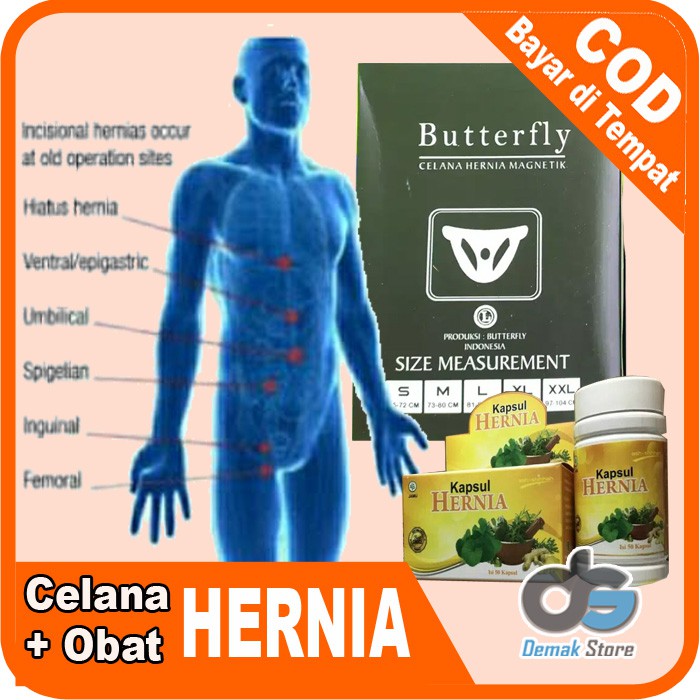 PAKET CELANA HERNIA BUTTERFLY + OBAT HERNIA HERBAL