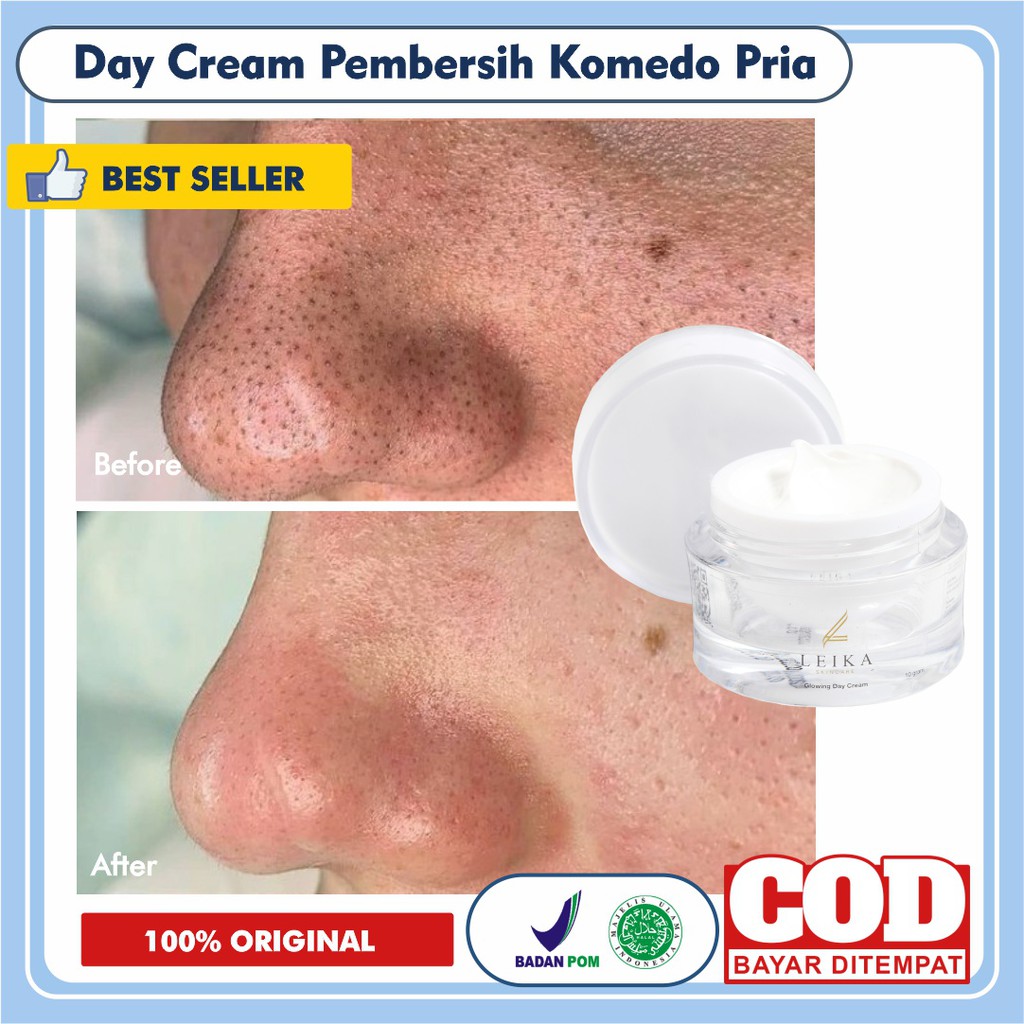 [CREAM PEMBERSIH KOMEDO] Krim Penghilang Komedo Dan Pengecil Pori Penghilang Komedo Hidung Penghilan