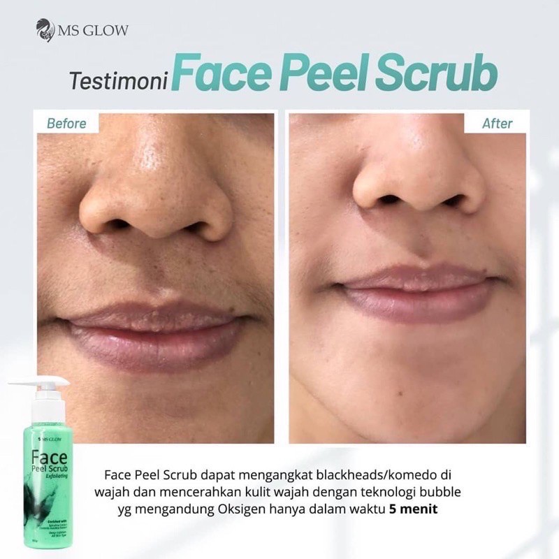 Ms Glow Face Peel Scrub Original