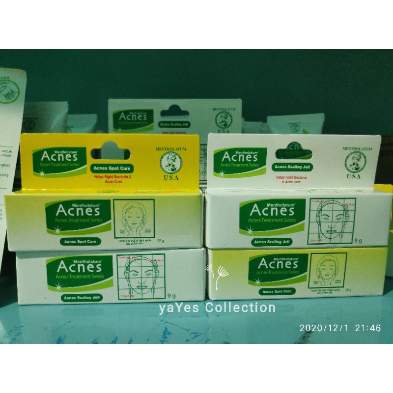 Acnes Treatment Series 50g Tea tree oil clay creamy wash Acne point clear roll on sealing jell spot