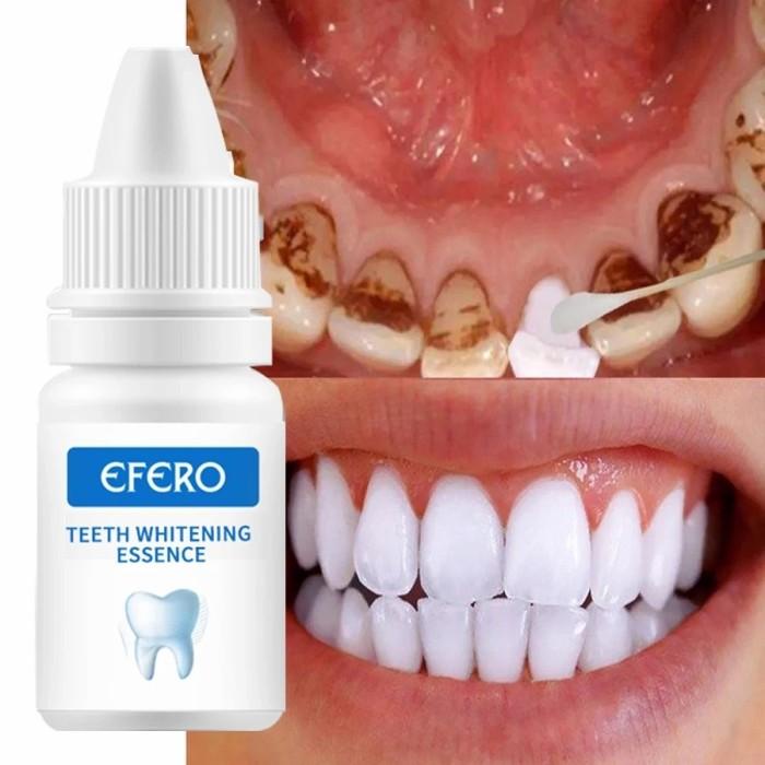 Vier | Cairan Pemutih Gigi Penghilang Noda Plak Efero Teeth Whitening Essence
