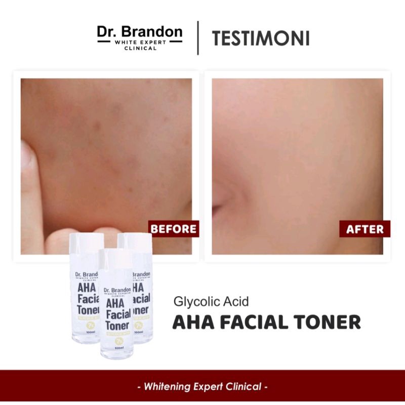 Dr. Brandon AHA Facial Toner 100ml