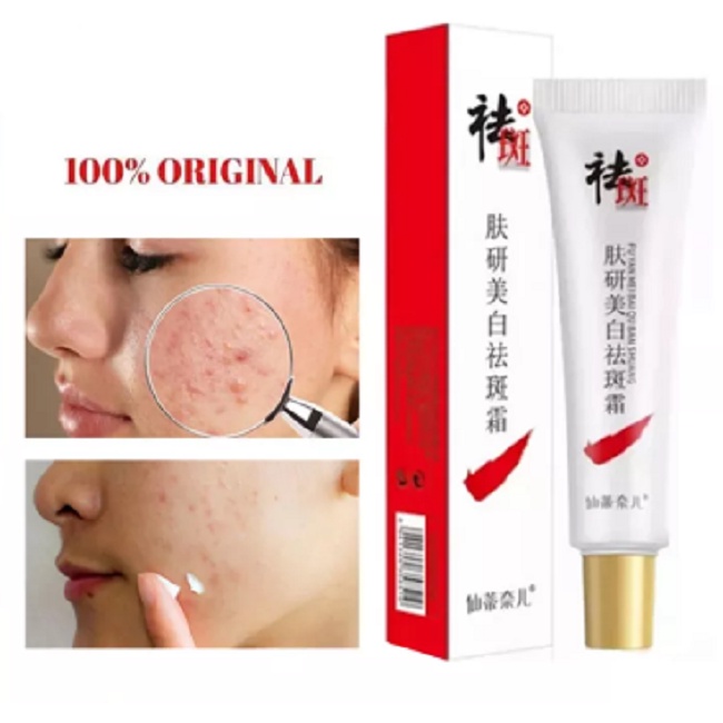 Cream Jerawat Salep Penghilang Bekas Jerawat dan Flek Hitam 20ml