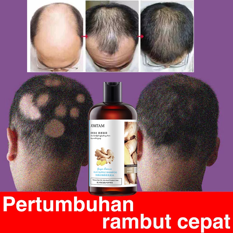 [100% asli] Shampo Penumbuh Rambut Cepat Serum Rambut Rontok Botak Rontok Penumbuh Rambut Perawatan Hair Care Treatment Anti Rambut Rontok