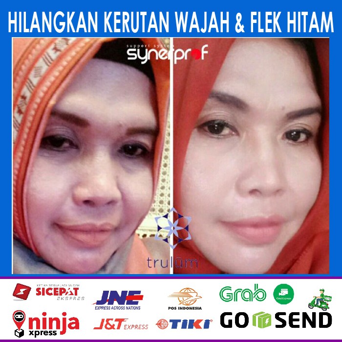 ´RV Krim Untuk Menghilangkan Flek Hitam Membandel - Serum Untuk Memutihkan Leher Pria Trulum