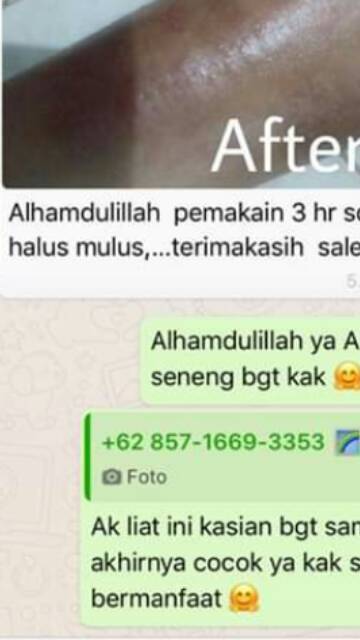Crim buat gatal menahun..