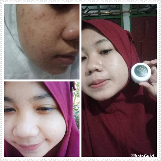 MH whitening skin