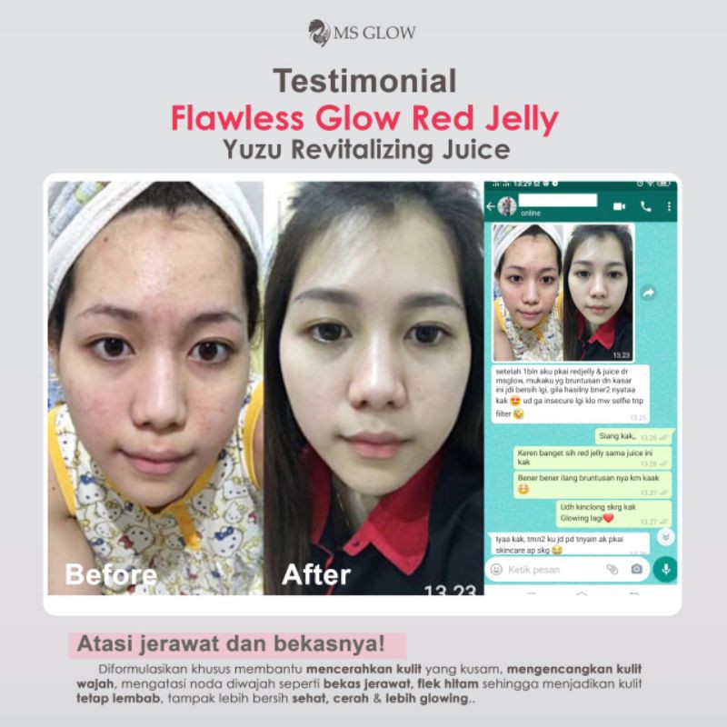 Flawless Glow red jelly msglow super glowing ampuh mencerhakan