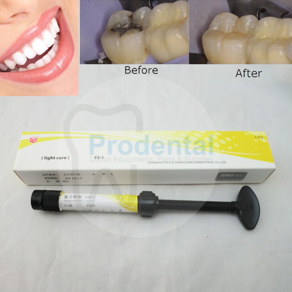 Lem behel veneer komposit bahan tambal gigi veneer light cure laser dental composite