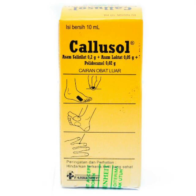 Callusol Obat Kutil Mata Ikan Kapalan