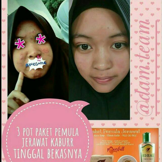 PAKET PEMULA SR12 Herbal Skncare BPOM Detoks Aman Mencerahkan Kulit Kinclong Bebas Jerawat Dan flek