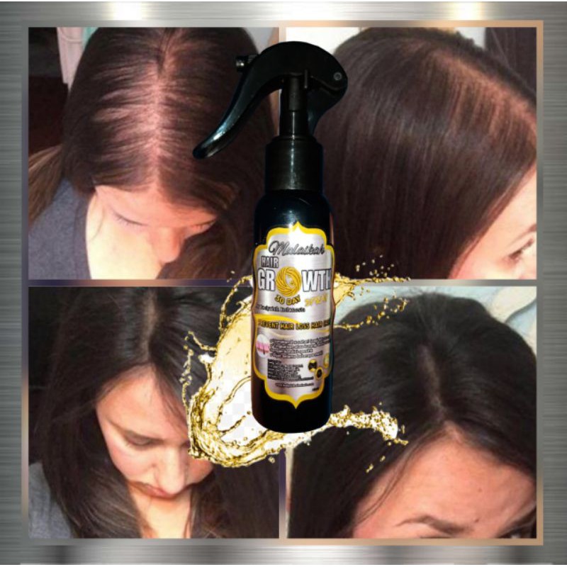 Malaikah Hair Growth Serum Obat Penumbuh Rambut Botak dan Rontok Parah