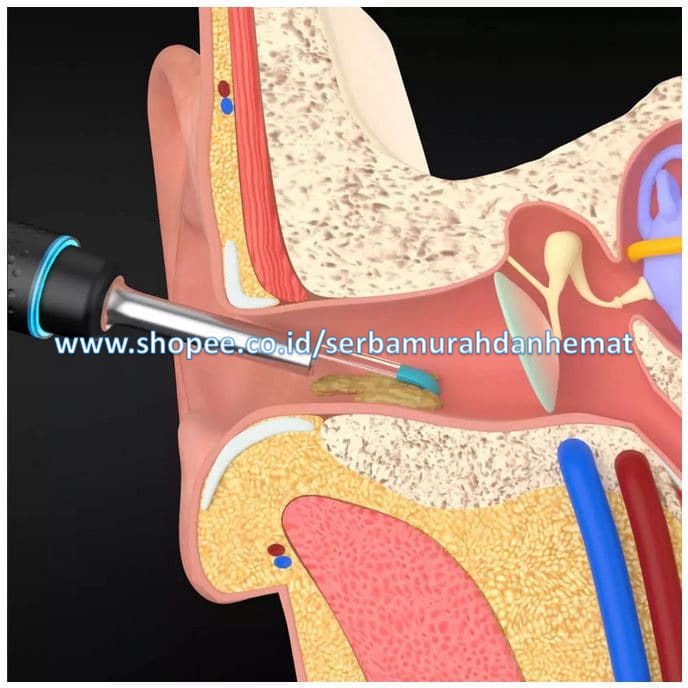 Kamera Korek Kuping Pembersih Telinga Otoskop Ear Otoscope BEBIRD M9 Pro Smart Visual