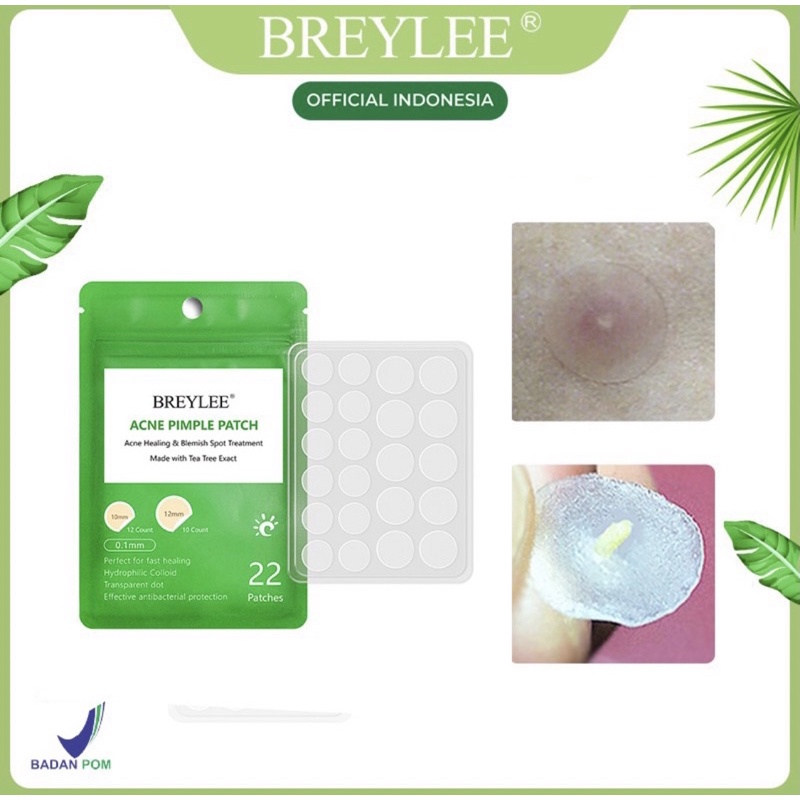 Breylee Acne Pimple Patch