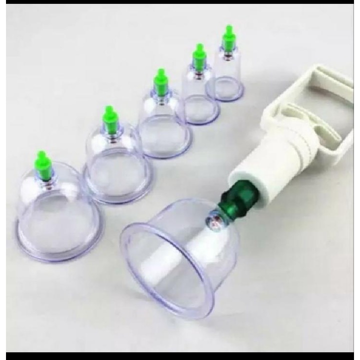 Jual (fashionstar9) Alat Bekam Kop Angin Alat Masuk Angin Alat Kerokan