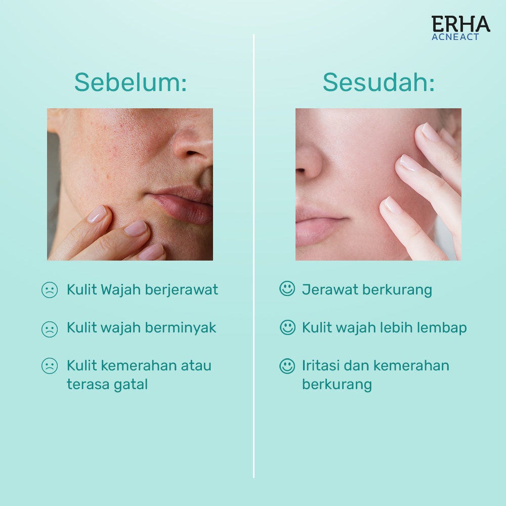 ERHA Toner Wajah Jerawat - ERHA Acne Clarifying Gel AHA BHA Niacinamide