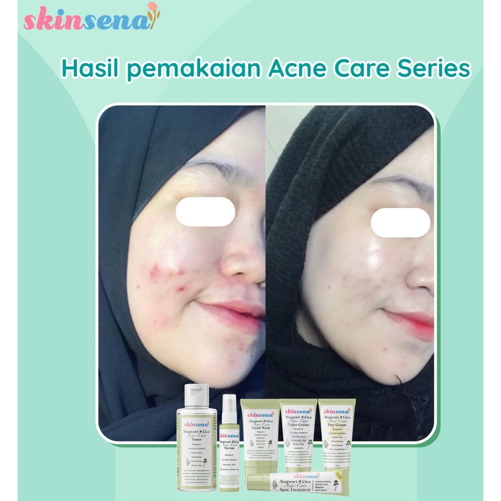 SKINSENA glowing mugwort cica acne care/toner / day / facial face wash cleanser / essence / serum / night cream / acne spot gel / mask masker / body lotion / body scrub mini size full size glow murah bpom mencerahkan jerawat acne prone bruntusan skin sena