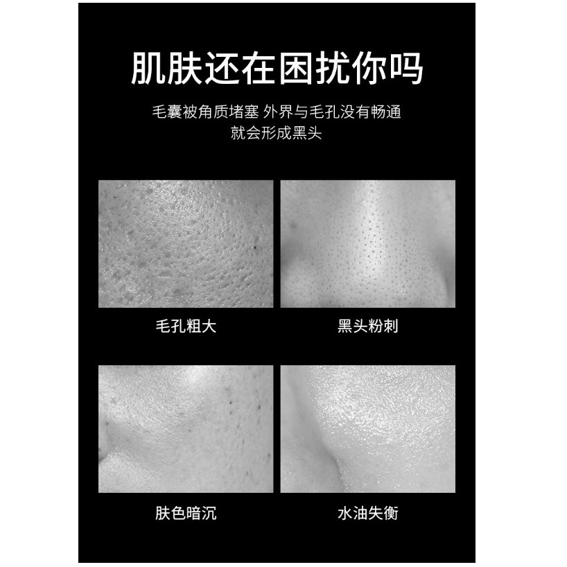 VENZEN Blackhead Remover Cleansing Masker Wajah Peel Off 60 Gr / Removed Black Head Original / Masker Wajah Peel Off Jerawat Masker Organik Masker Komedo Flek Hitam / Masker Korea Skincare Pemutih Wajah dan Glowing