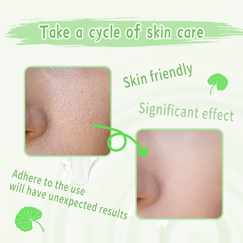 GIRLPAL 100g Centella Asiatica Peeling Gel Facial Body Exfoliating Brighten Skin Natural Moisturizer