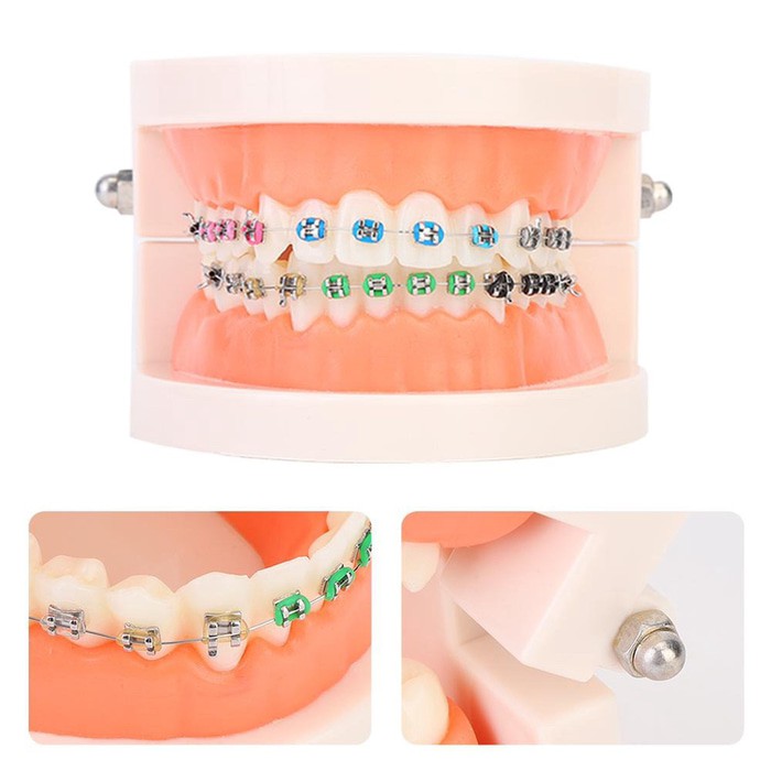 Dental model ortho study model orthodontic phantom studi behel braces bracket kawat gigi metal